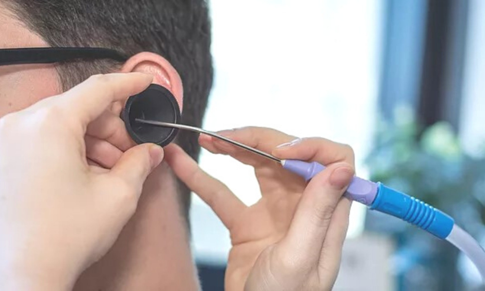 Microsuction Belfast