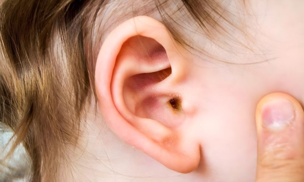Banner image for ClearEar Belfast article on causes of ear wax build-up.